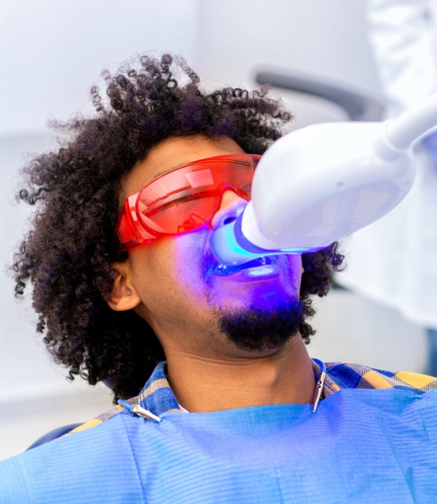 Teeth whitening