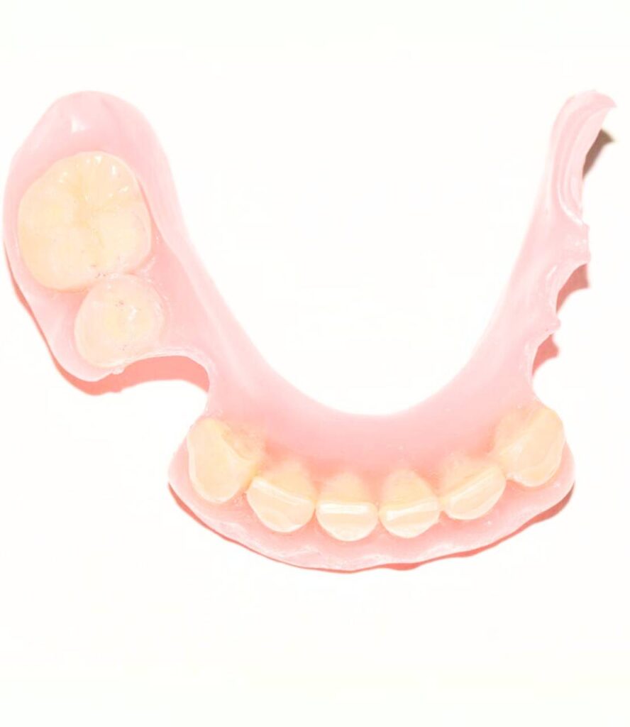 Removable partial denture