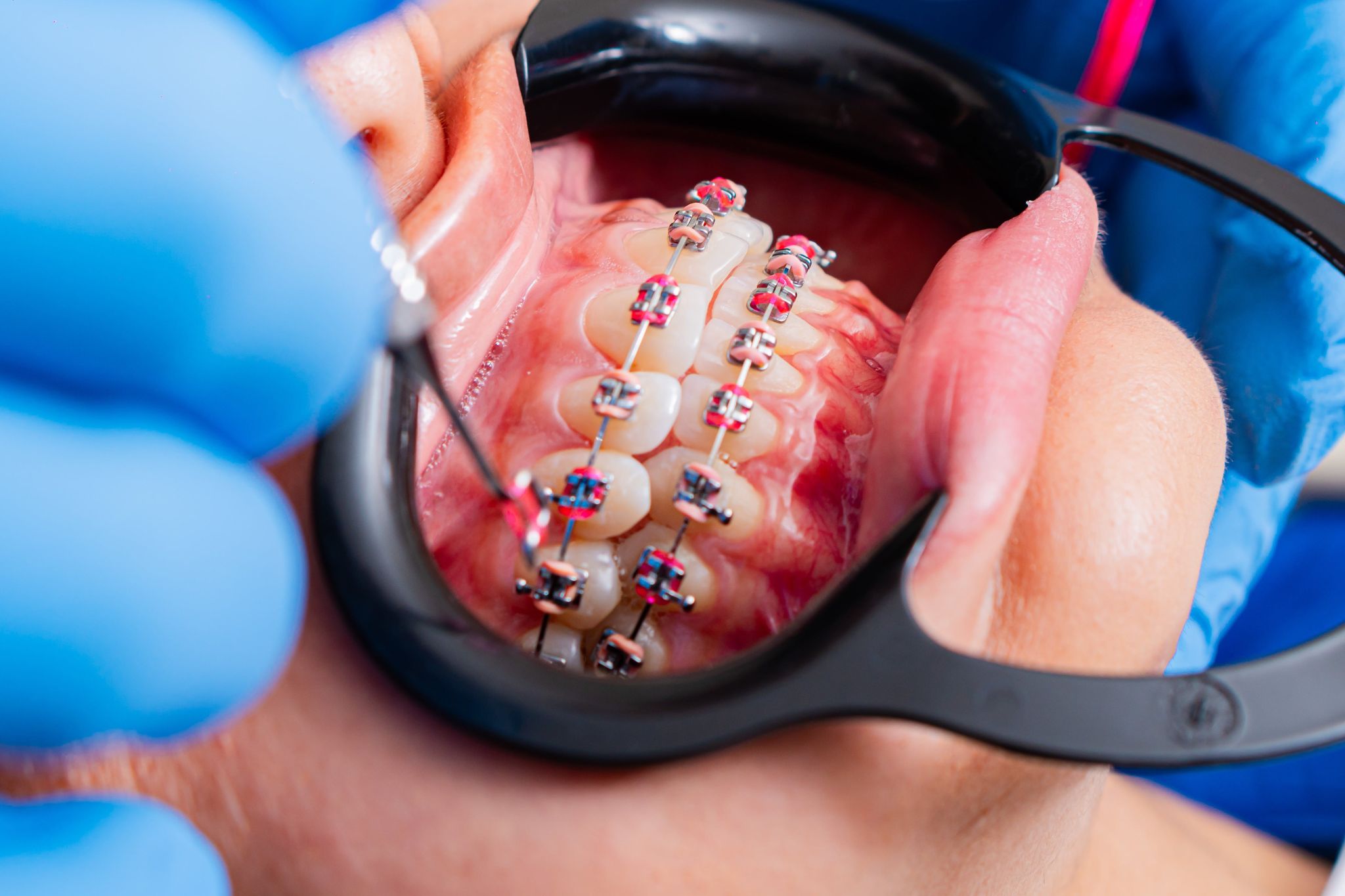 Meilleur orthodontiste à Genève
