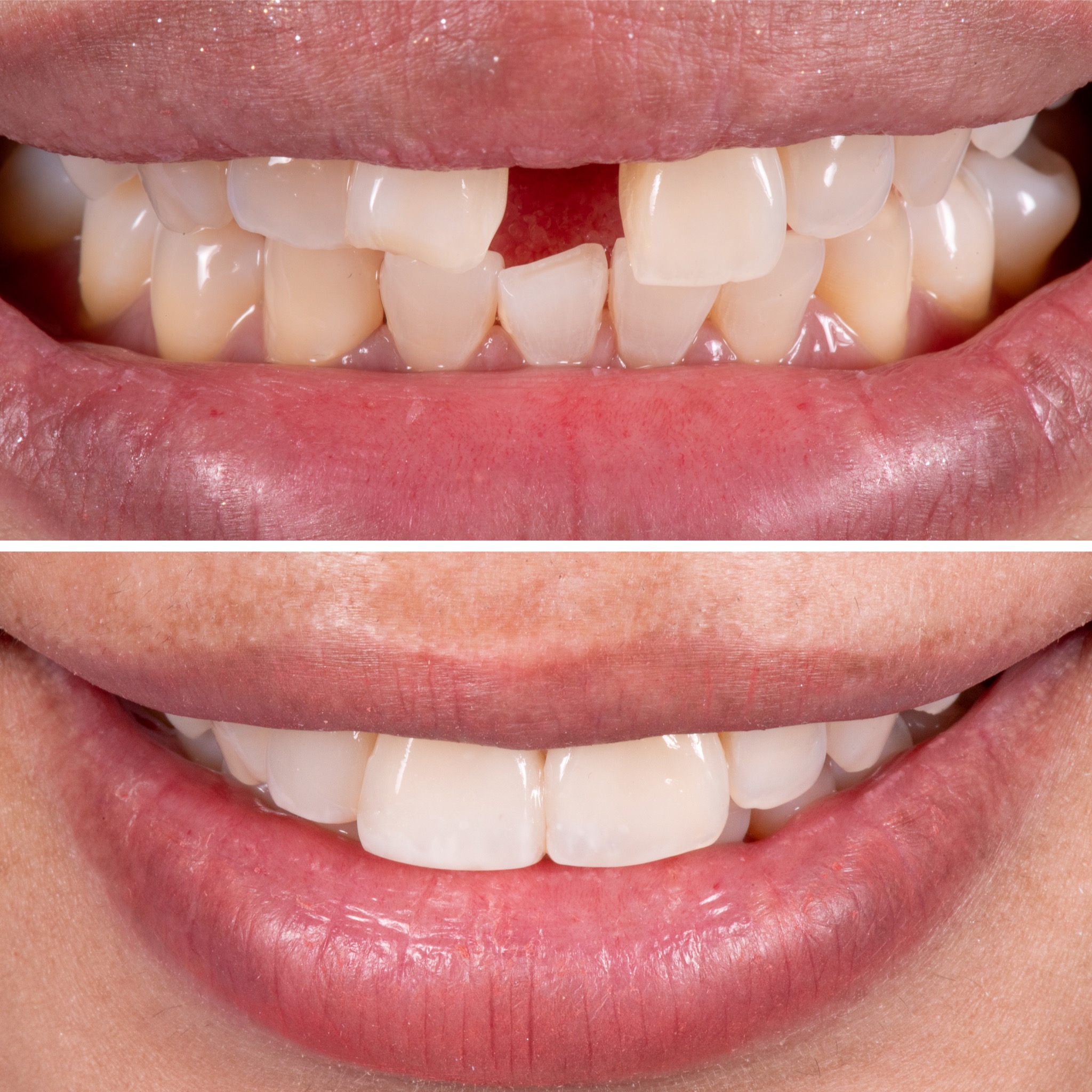 Dentiste Composite Genève