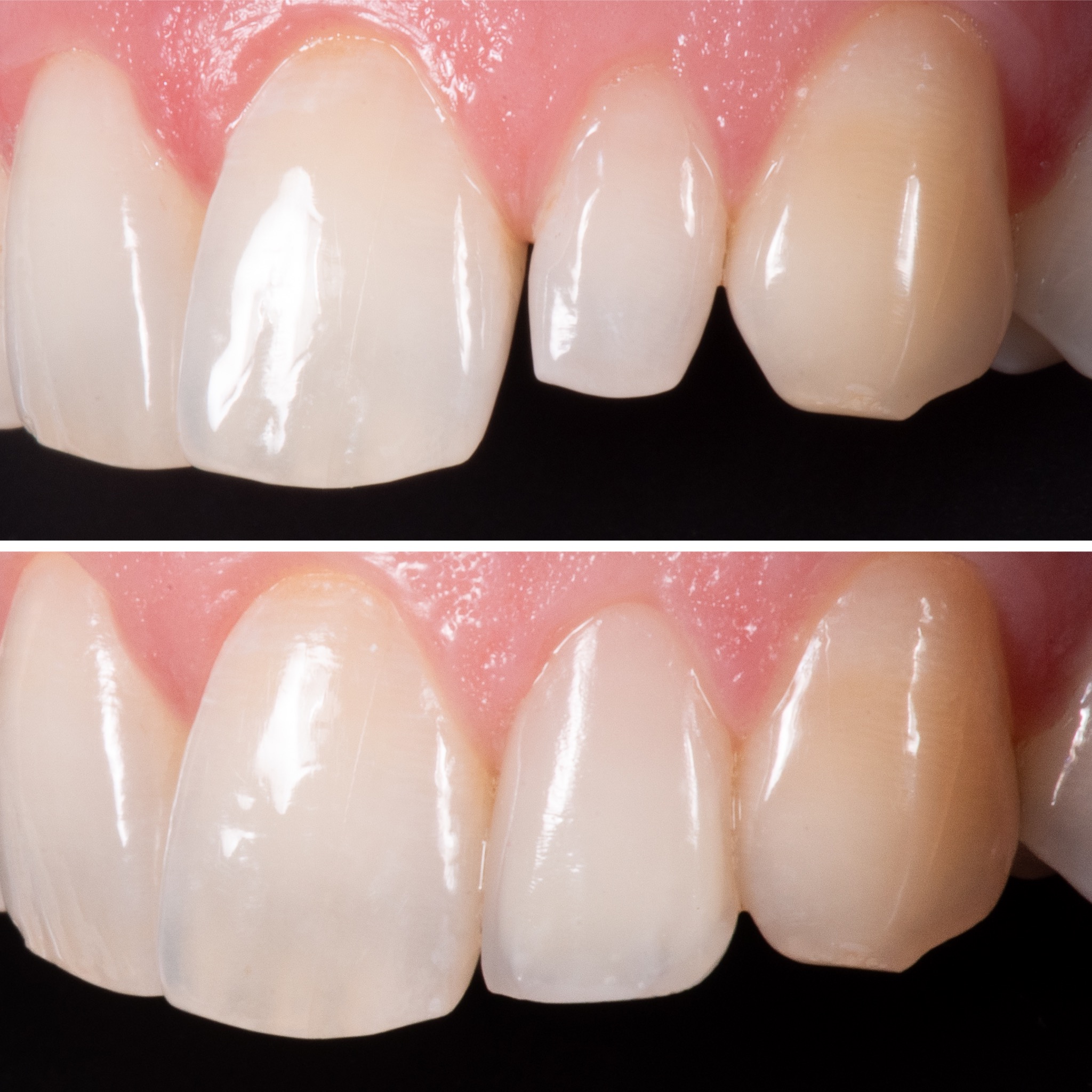Aura composite clinique dentaire